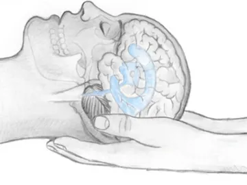 An illustration of the practice of craniosacral therapy. The provider's hands gently cup the patient's head from below, touching the base of the skull and cradling the rear of the skull. The illustration shows the patient's brain and part of the skull transparently through the skin